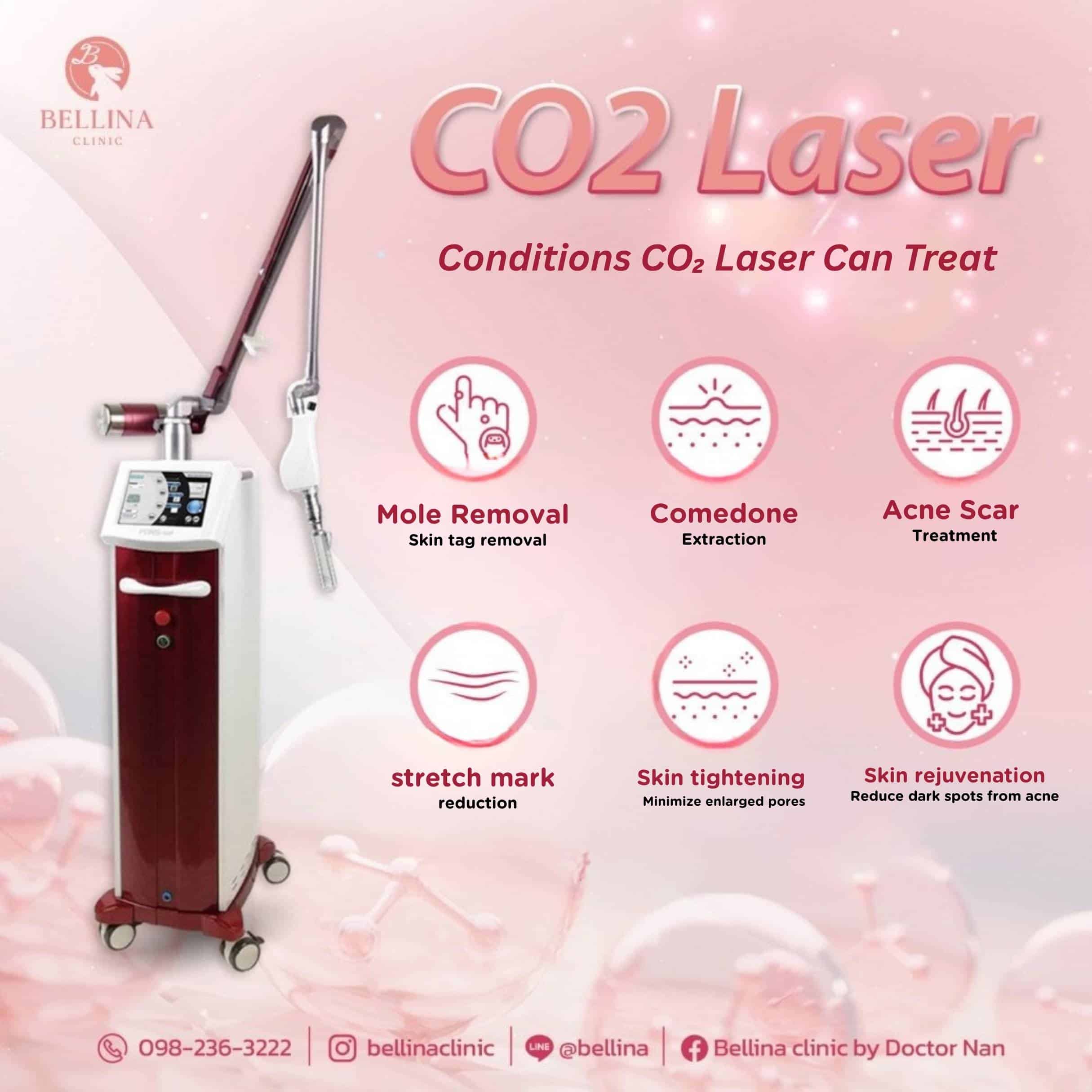 CO2 laser machine and conditions it can treat — mole removal, skin tags, age spots at Bellina Clinic Bangkok