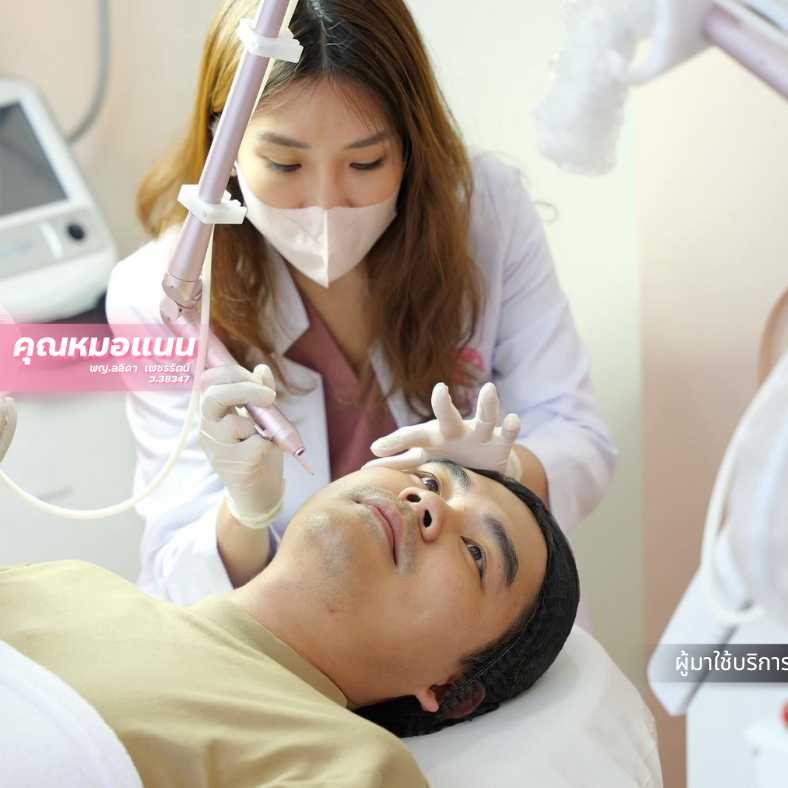 Dr. Nan performing CO2 laser mole removal at Bellina Clinic Bangkok
