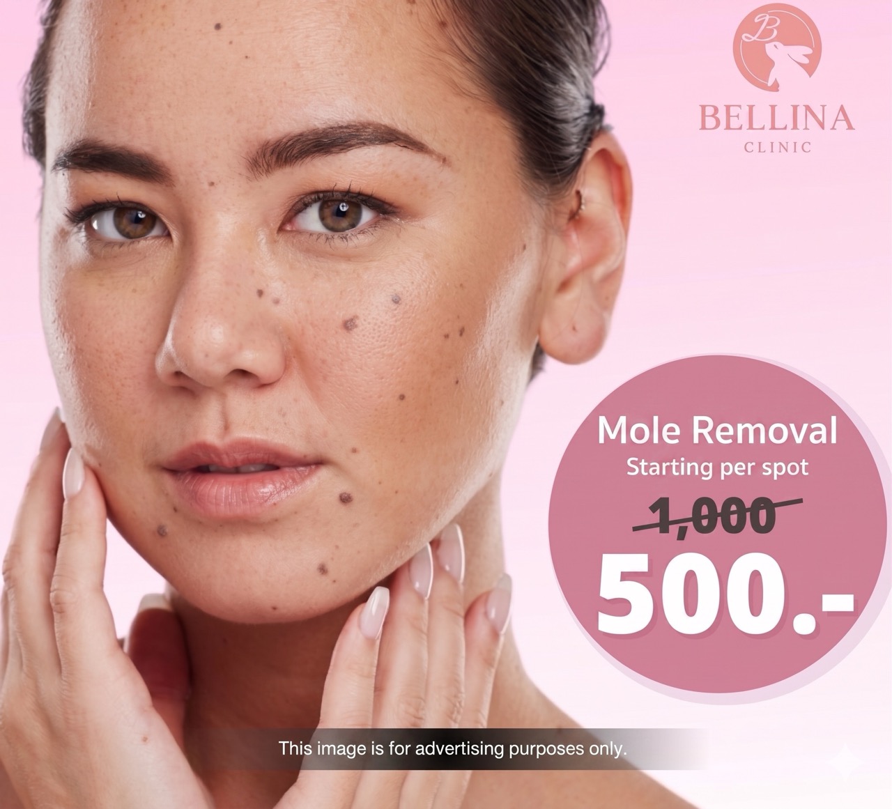 CO2 laser mole removal from ฿500 per spot at Bellina Clinic Bangkok